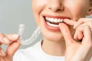 Invisalign Full o Invisalign Comprehensive